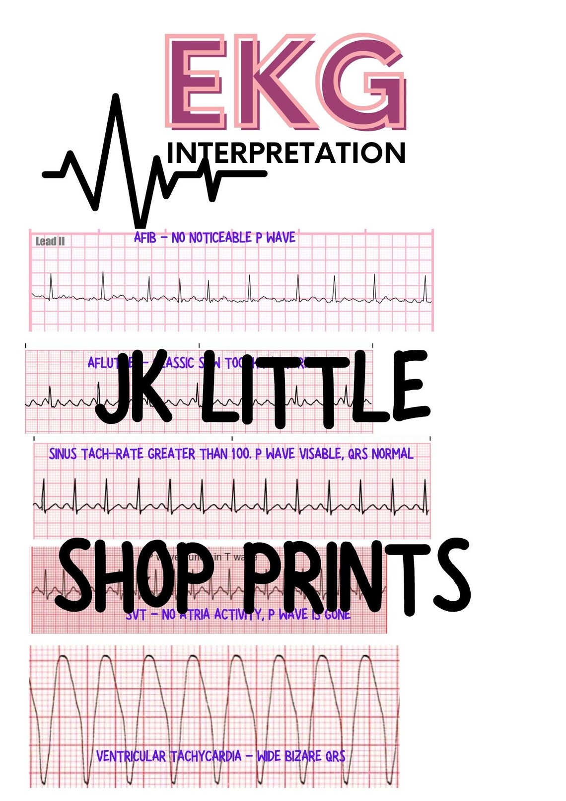 EKG Interpretation, Easy Steps for Ekg, Nursing Notes, Nursing Made