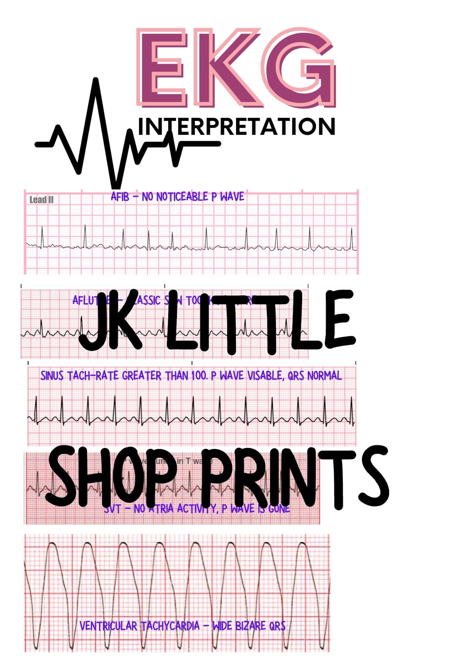 EKG Interpretation, Easy Steps for Ekg, Nursing Notes, Nursing Made