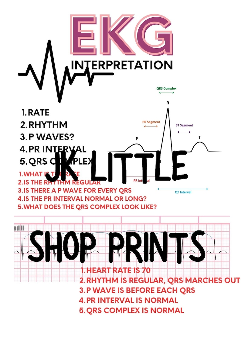 How To Read Ekg Registered Nurse Rn EKG Interpretation, Easy Steps for Ekg, Nursing Notes, Nursing Made