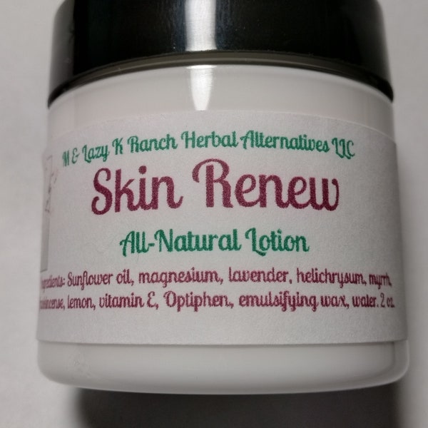 All-Natural Skin Renew Magnesium Skin Cream with Frankincense and Helichrysum Essential oils to lighten and renew your skin.  2 ounces
