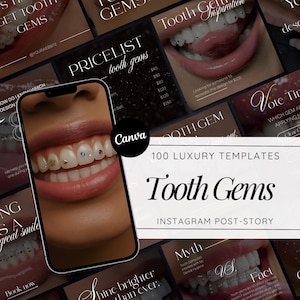 May include: A smartphone displays a close-up of a person's smile with tooth gems. The image is surrounded by Instagram post templates with text that reads "Tooth Gems" and "100 Luxury Templates".