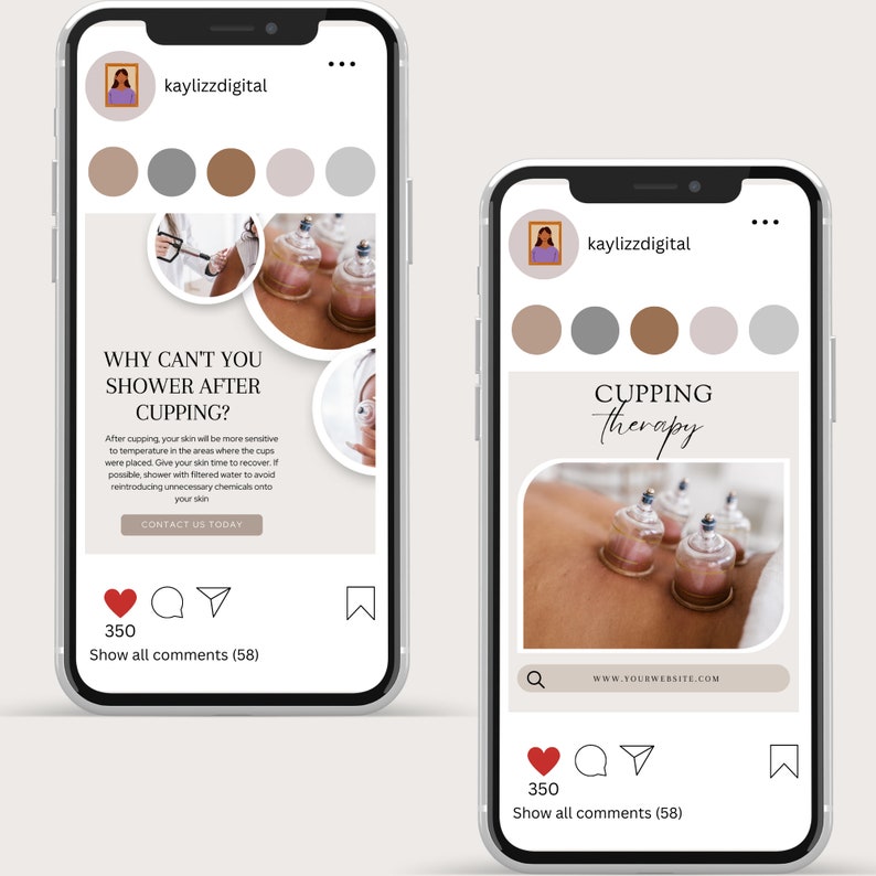 Inlägg om koppningsterapi på sociala medier, hijama-mall för Instagram, inlägg om koppningsmassage, Instagram-story, inlägg om hijama-engagemang bild 6