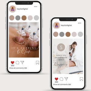 Inlägg om koppningsterapi på sociala medier, hijama-mall för Instagram, inlägg om koppningsmassage, Instagram-story, inlägg om hijama-engagemang bild 4