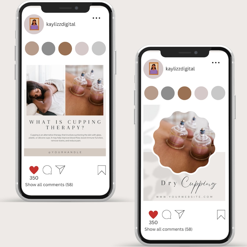 Inlägg om koppningsterapi på sociala medier, hijama-mall för Instagram, inlägg om koppningsmassage, Instagram-story, inlägg om hijama-engagemang bild 9