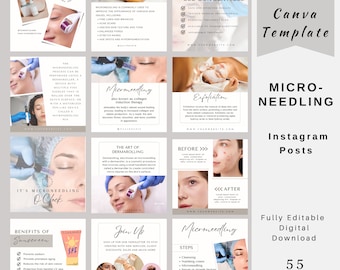 Microneedling Instagram Template, Esthetician Posts, Facial Scalp Microneedling, Skincare Social Media, RF Microneedling, Dermarolling Posts