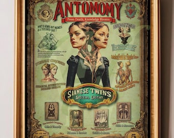 Siamese Twins Anatomical Print: Vintage Medical Curiosity Art