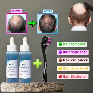 Quick-Absorbing Hair Growth Serum | With Saw Palmetto & Jojoba Oil | For All Hair Types&quot;*