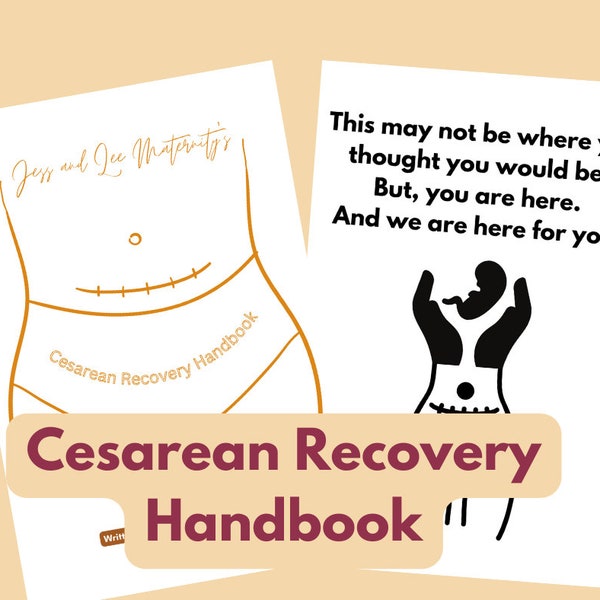Cesarean Birth Recovery Handbook - A Guide for Optimal C Section Recovery, C section Journal, Birth Journal