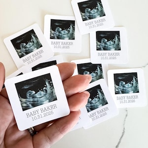 Decoraciones para baby shower con ultrasonido, confeti para ultrasonido, decoraciones personalizadas para bebés, anuncio de embarazo, decoración de mesa