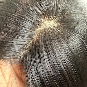 Può includere: Primo piano del cuoio capelluto di una persona con capelli castano scuro. I capelli sono divisi al centro e il cuoio capelluto è visibile.