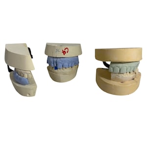 May include: Three dental molds of teeth in different positions. The molds are made of a light beige material, with blue and green teeth models. One mold is angled, and the others are upright. The molds are used for dental study and practice.