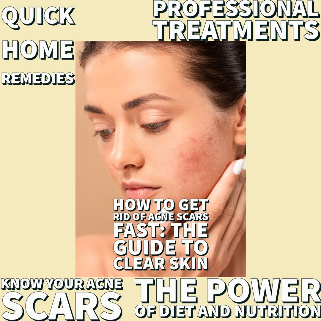 How to Get Rid of Acne Scars Fast the Guide to Clear Skin Etsy