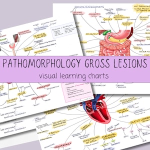 Puede incluir: Un conjunto de cuatro tablas de aprendizaje visual coloridas para estudiantes de medicina. Las tablas representan diferentes órganos y condiciones, incluyendo el corazón, los pulmones, el estómago y los intestinos. Las tablas están etiquetadas con términos médicos e ilustraciones.