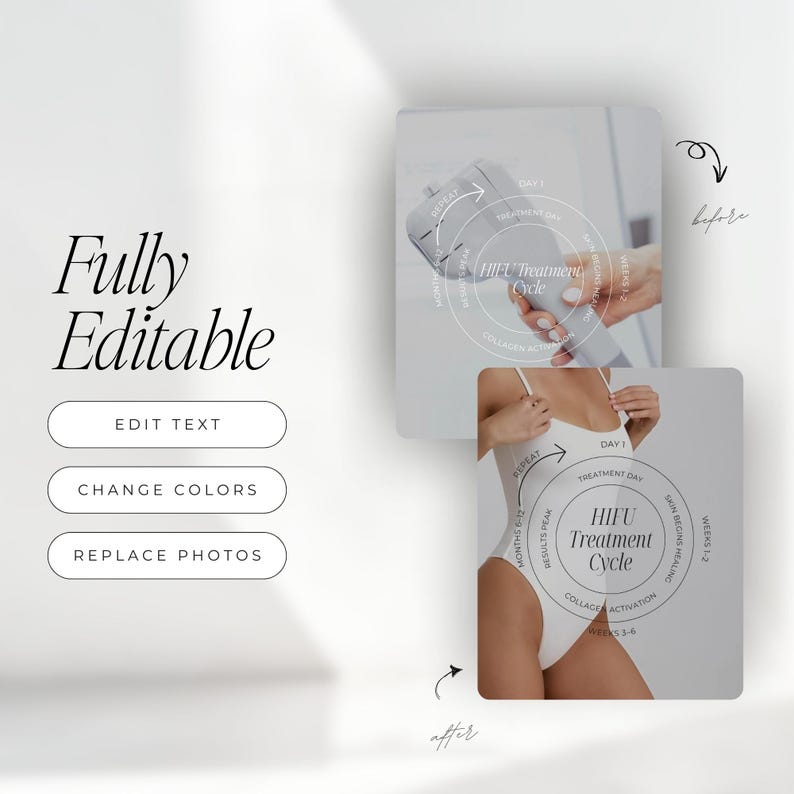 Peut inclure: Image promotionnelle avec le texte "Enti&egrave;rement modifiable" et des options pour modifier le texte, changer les couleurs et remplacer les photos. L'image comprend &eacute;galement des sch&eacute;mas illustrant le cycle de traitement HIFU.