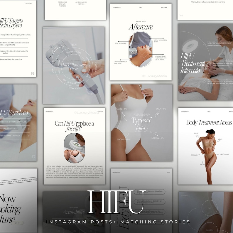 Peut inclure: Une collection de publications Instagram et d'histoires correspondantes sur les traitements HIFU. Les publications pr&eacute;sentent du texte et des graphiques d&eacute;taillant les couches de la peau, les soins post-traitement, les intervalles de traitement et les zones de traitement du corps. La palette de couleurs est principalement blanche et grise.