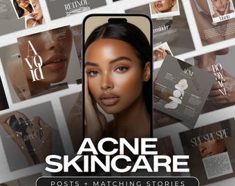 Modelos de cuidados com a pele de luxo para Instagram | Postagens de mídia social para esteticistas | Modelo para especialista em acne | Postagens sobre cuidados com a pele | Postagens sobre acne | Cuidados com a pele e acne