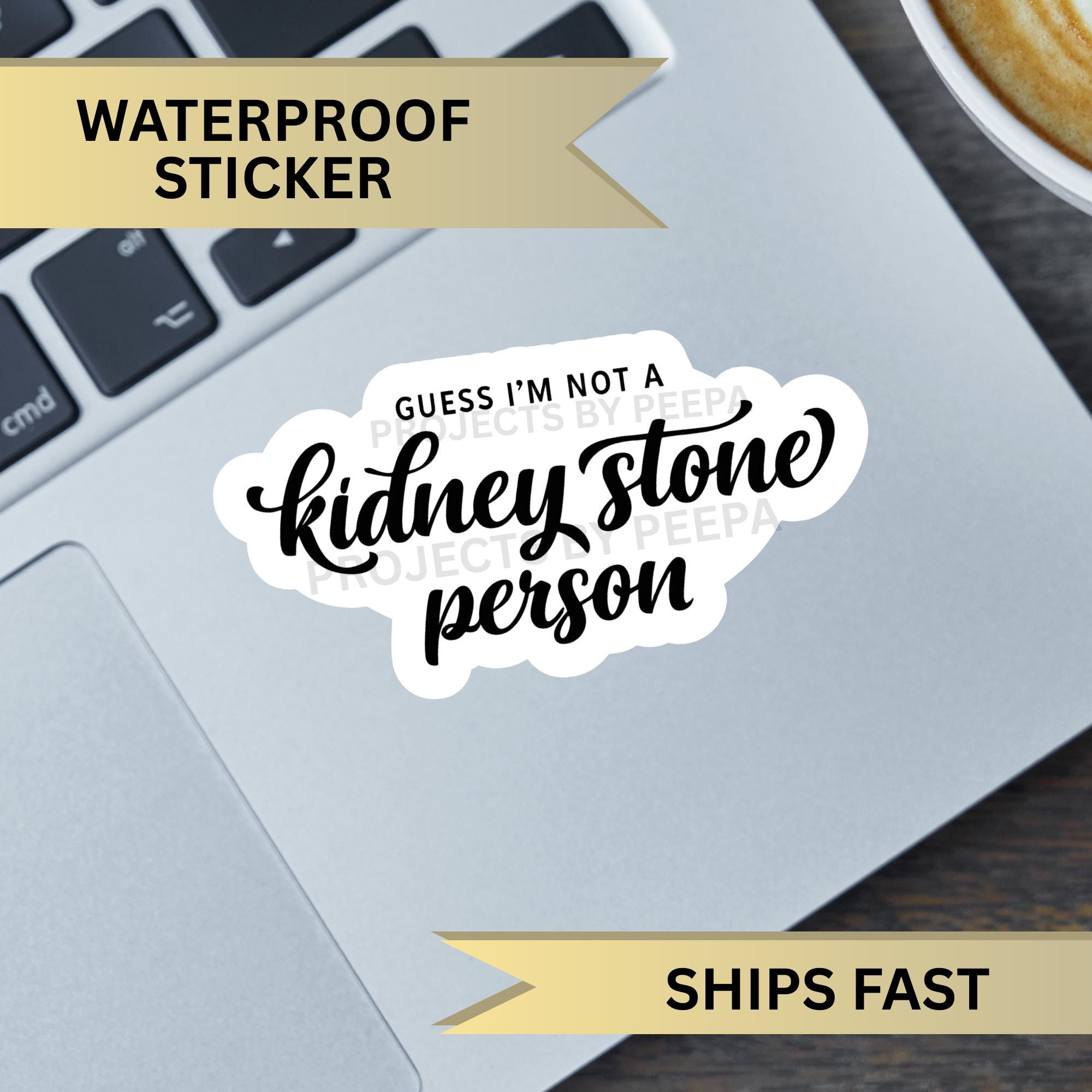 Holographic Kidney Stone Sticker, Handmade Ureteroscopy Surgery Gift ...