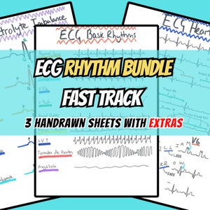 ECG Rhythms Bundle