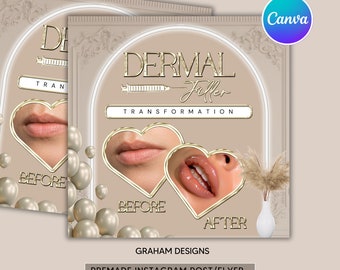 Dermal Filler Transformation Post, Aesthetics Instagram Template (Canva Pro)