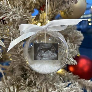 Adorno navideño personalizado con foto de ecografía de embarazo, ideal para el árbol de Navidad.