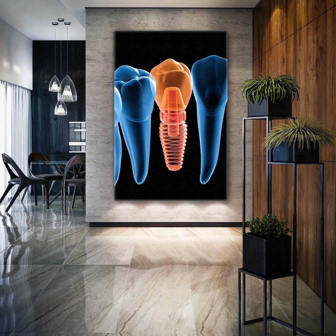 Implant Wall Art, Dentist Wall Decor, Dental Health Wall Art, Roll up