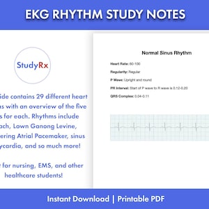 EKG Rhythm Notes| Paramedic | Nursing Study Guide | Med School | NCLEX | EMT