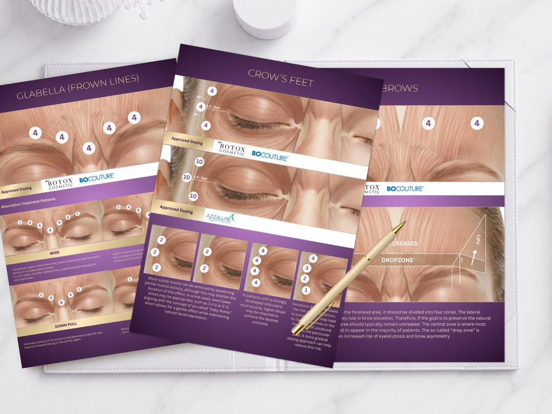 Botox Injecton Pattern For Men Botox Injection Patterns Template | Facial Mapping Guide | Botulinum ...