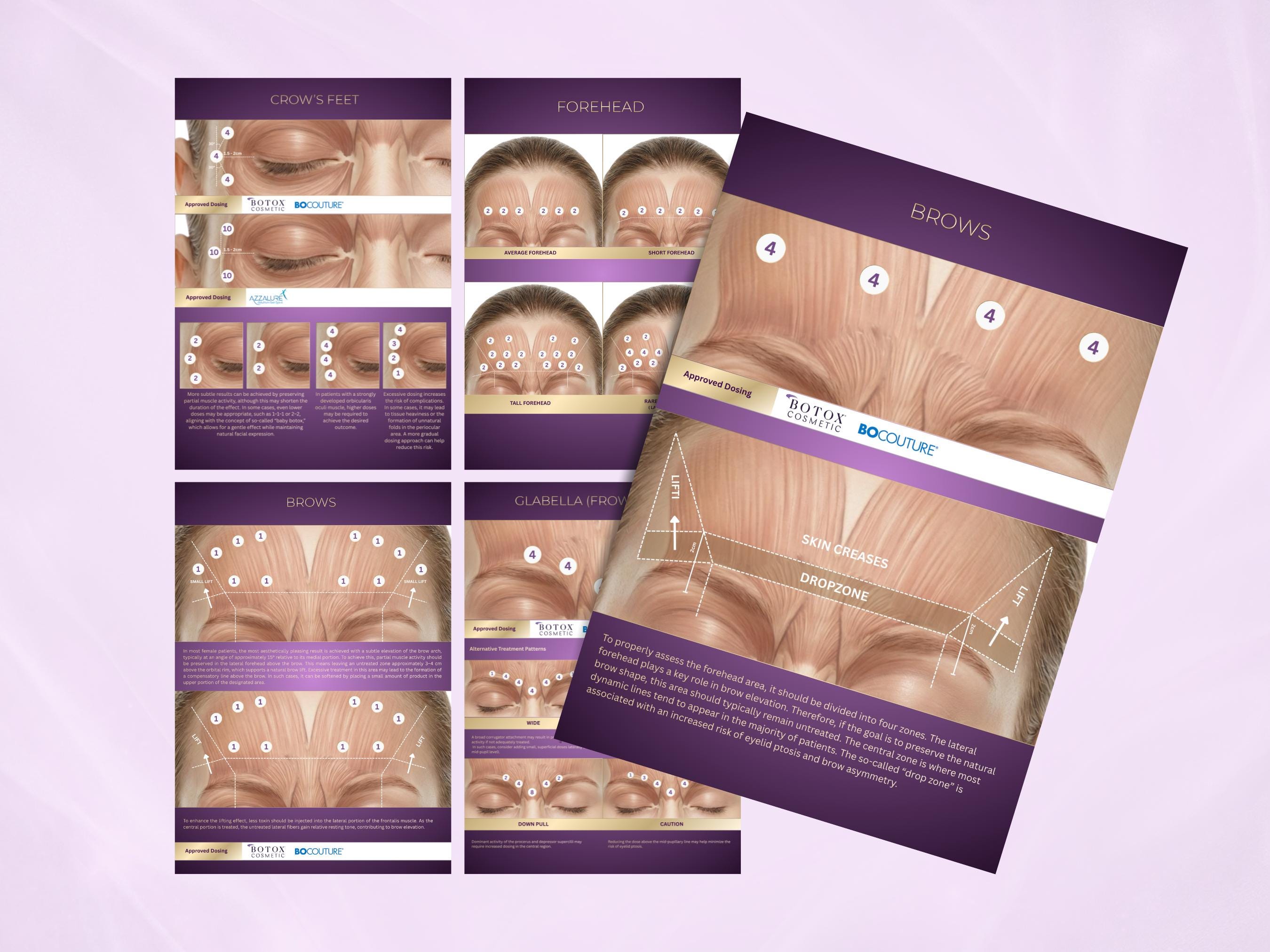 Botox Injection Patterns Template | Facial Mapping Guide | Botulinum ...