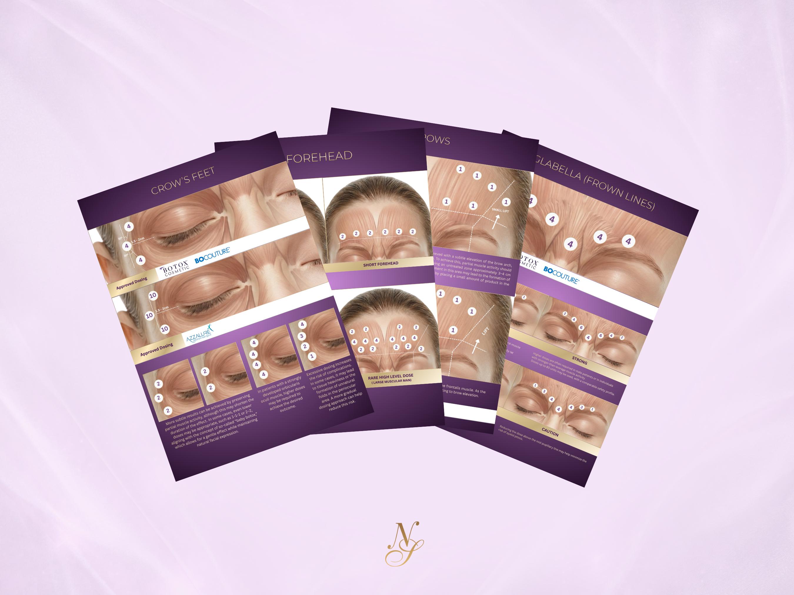 Botox Injection Patterns Template | Facial Mapping Guide | Botulinum ...