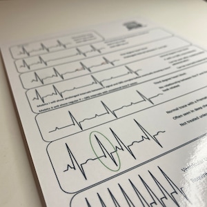 Carte de référence ECG/capnographie