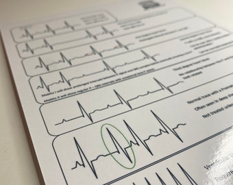 ECG/Capnography Reference Card