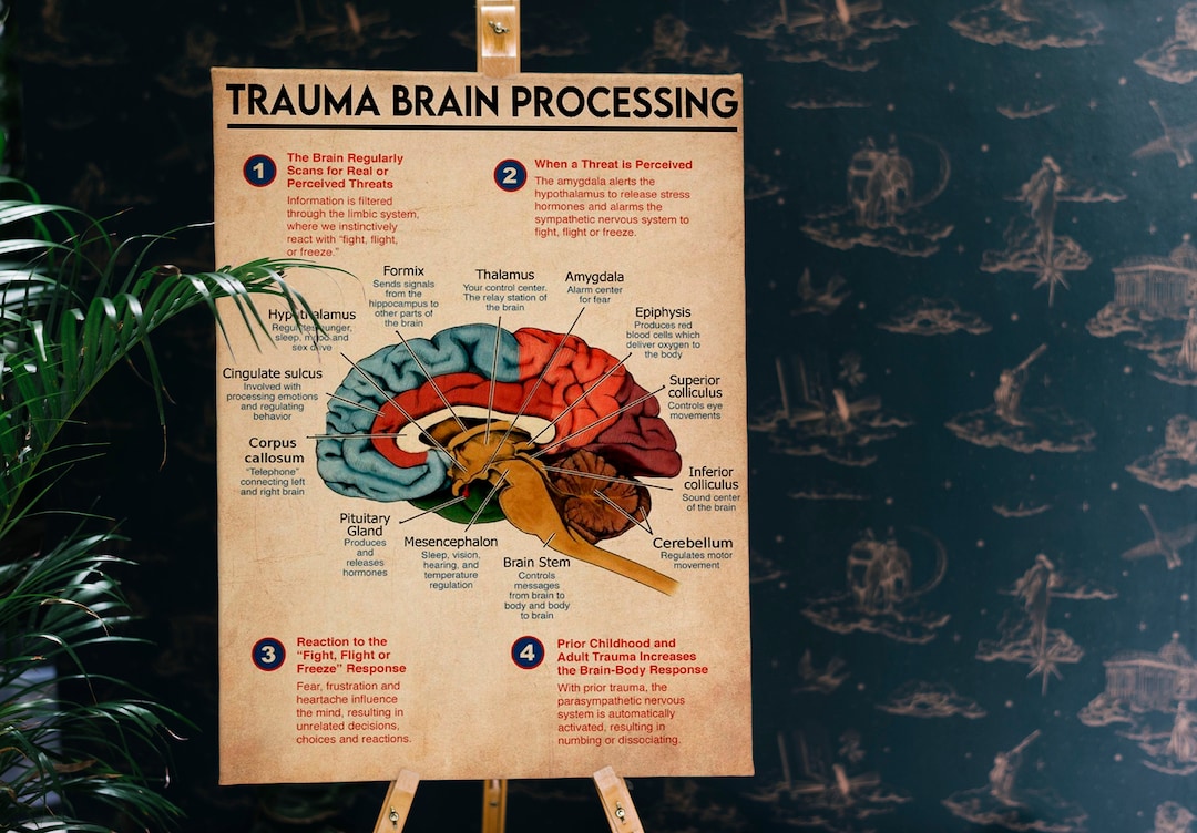 Trauma Brain Processing Poster Brain Wall Art Therapist - Etsy