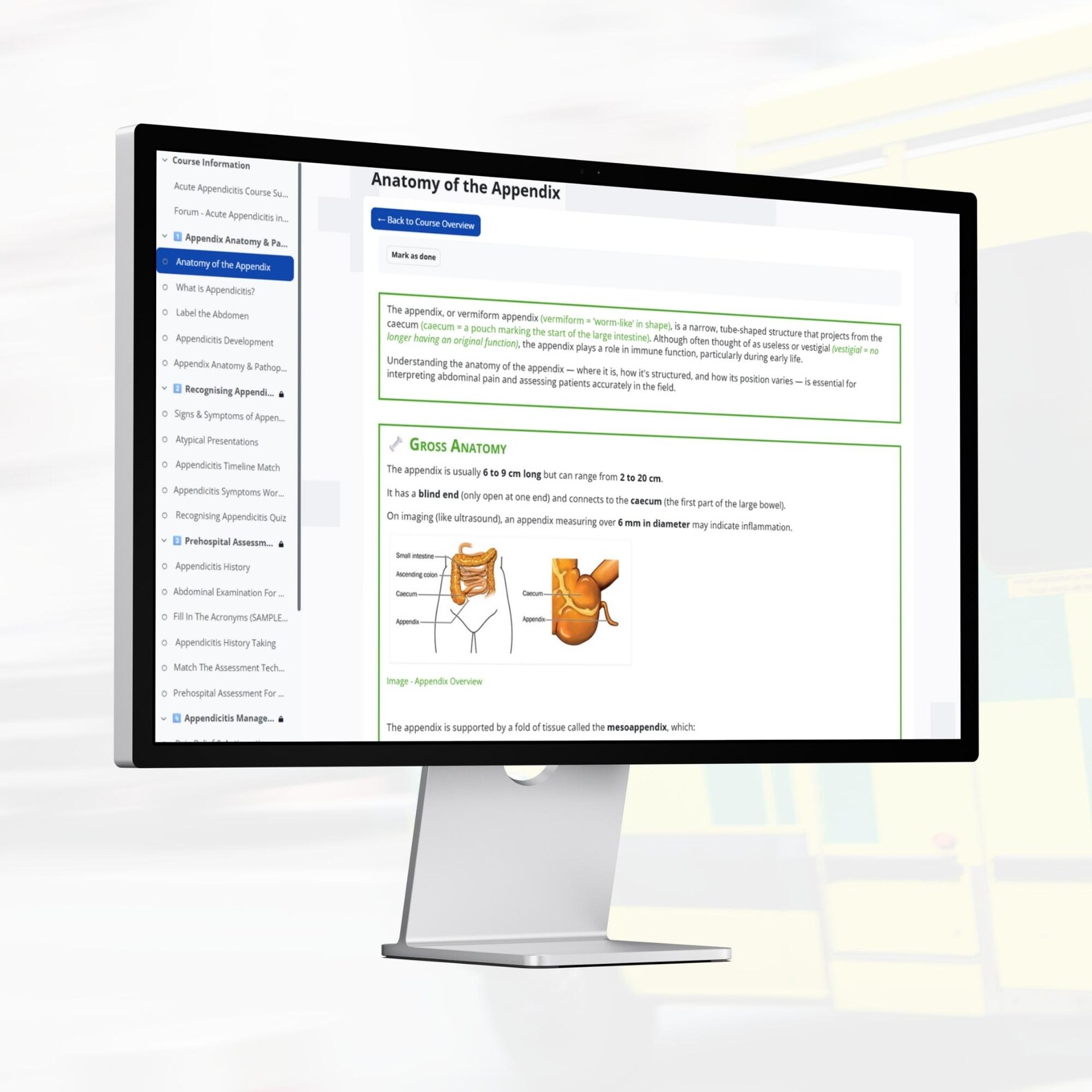 Online CPD Course: Acute Appendicitis in Prehospital Care - Etsy
