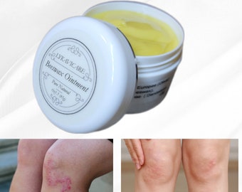 Beeswax Ointment, Psoriasis cream, Psoriasis relief,  Eczema relief, Natural Cream for Dry Skin, Fast Absorbing, Skin Care Cream,