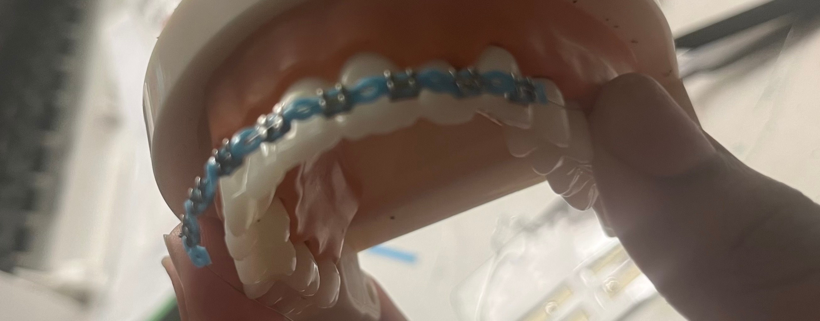 Fake Aesthetic Braces, Fashion Braces, Teeth Gem, Fake Braces Fake