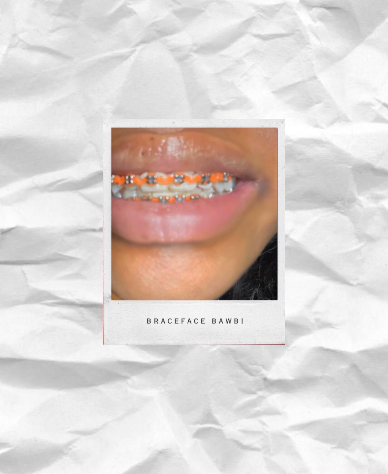 Fake Aesthetic Braces, Fashion Braces, Teeth Gem, Fake Braces Fake