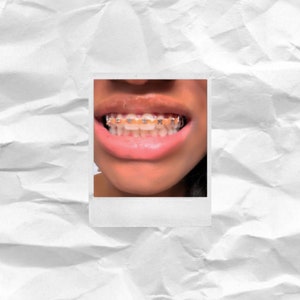 Fake aesthetic braces, fashion braces, teeth gem, fake braces image 3