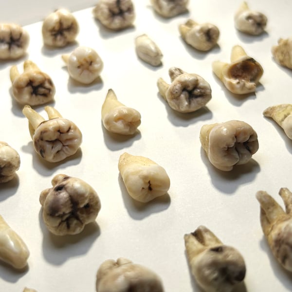 Fake Human Teeth - Etsy