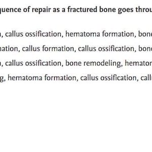 May include: A medical question on a white background. The question asks about the correct sequence of bone repair after a fracture. Four answer choices are listed, with option B highlighted. The letter "B" is also displayed below the question.
