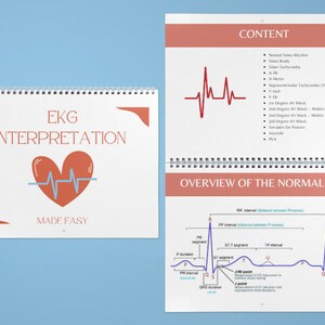 EKG Interpretation 4x6 Flashcards Printable - Etsy