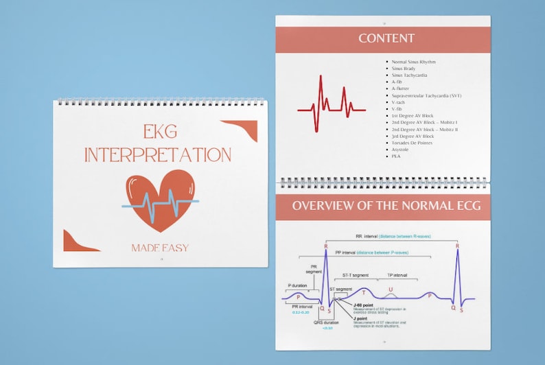 EKG Interpretation 4x6 Flashcards Printable - Etsy