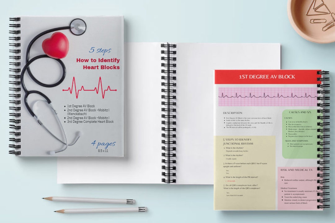 5steps How to Identify Heart Blocks Cheat Sheet Etsy