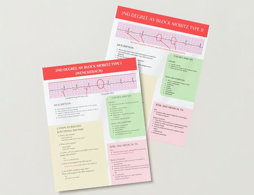 5steps How to Identify Heart Blocks Cheat Sheet Etsy