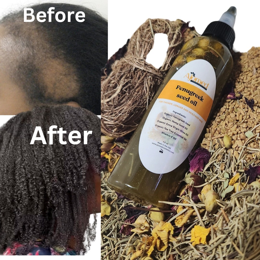Fenugreek Rosemary & Peppermint Hair Growth Oil. Organic Dht Blocker