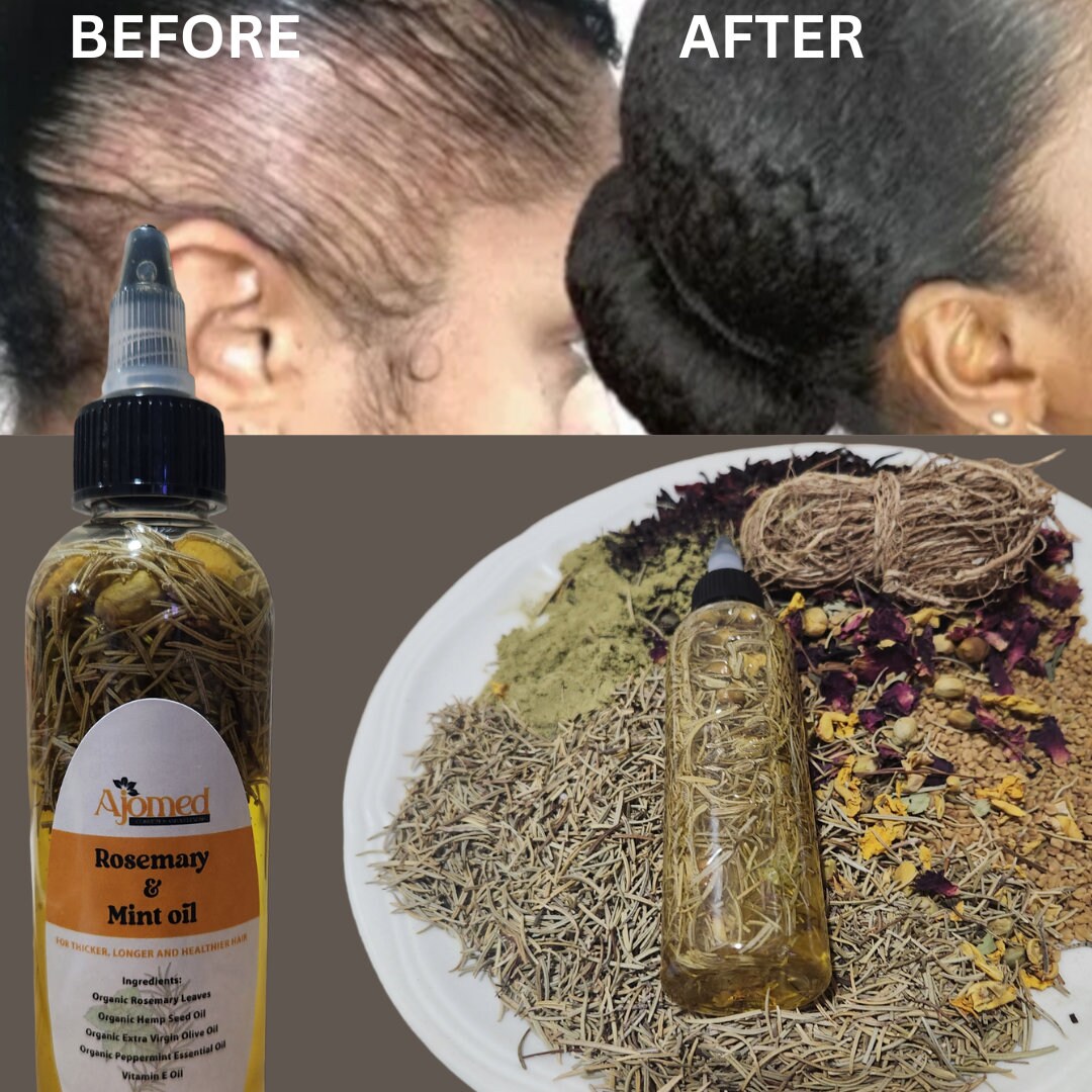 Rosemary & Mint Hair Growth Oil for Itchy Scalp Dandruff Etsy