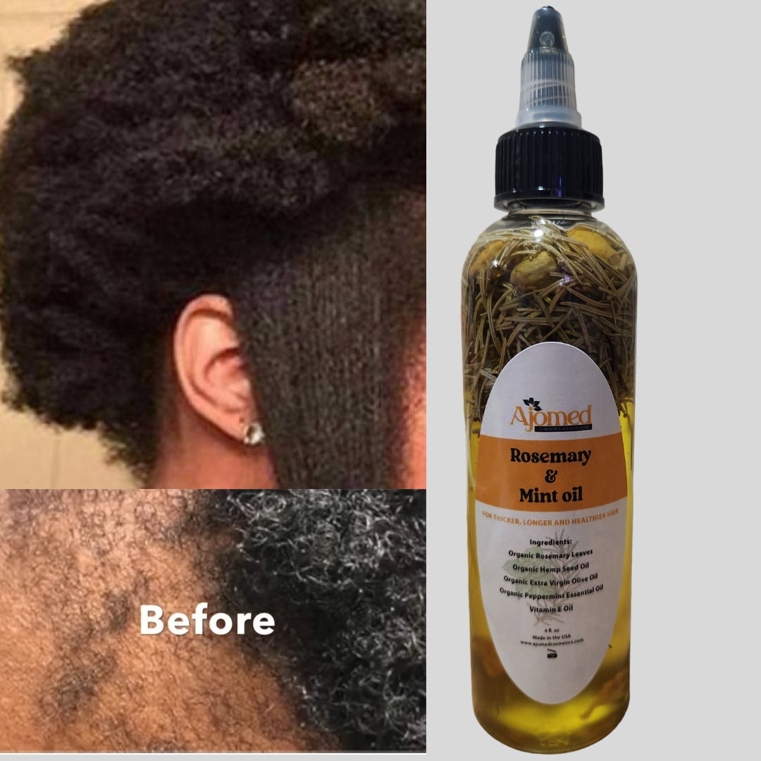Rosemary & Mint Hair Growth Oil for Itchy Scalp Dandruff, Organic