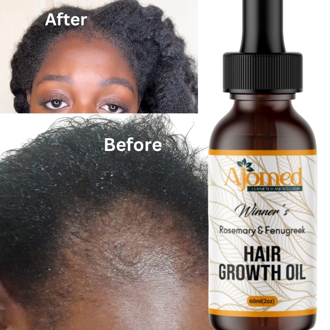 Rosemary Oil for Hair Growth, Fenugreek Hair Growth Oil, Amla, Henna ...