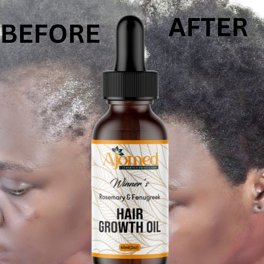 Intense Hair Growth Oil With Fenugreek Oil Rosemary Amla for Etsy