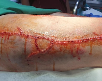 Sydd ärrprotes – Silikon SFX Makeup Ärr – Skräckfilmseffekt