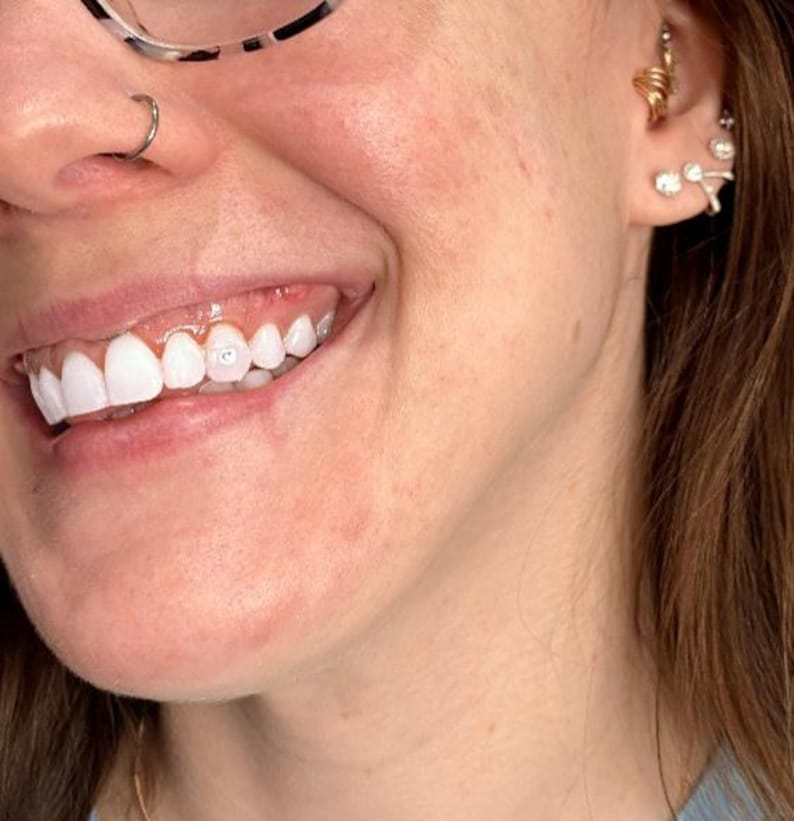 May include: Close-up of a person's smiling mouth with bright white teeth. A small gem is affixed to one tooth. The person is wearing a nose ring and glasses. The ear has multiple earrings, including a gold spiral and several small, sparkly studs.